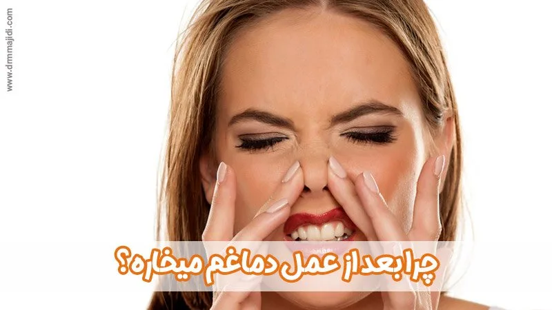 چرا بعد از عمل دماغم میخاره؟
